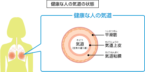 喘息 気管支喘息 ってどんな病気 チェンジ喘息 なるほど ぜんそく Com